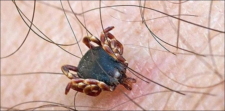 Congo Virus, Sindh, Karachi