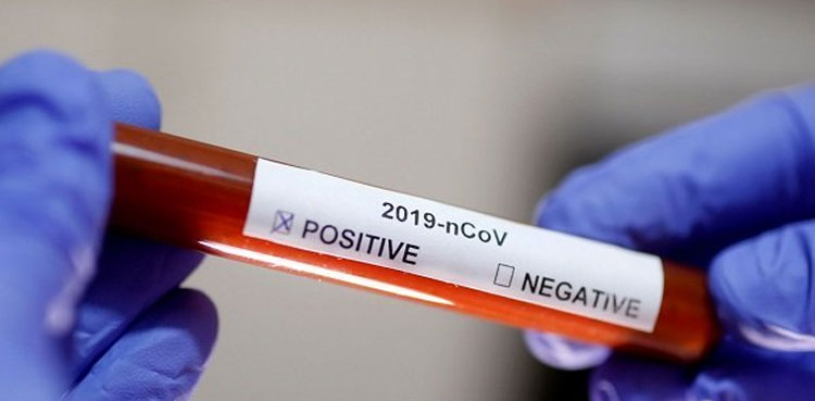 Hyderabad Positivity Ratio