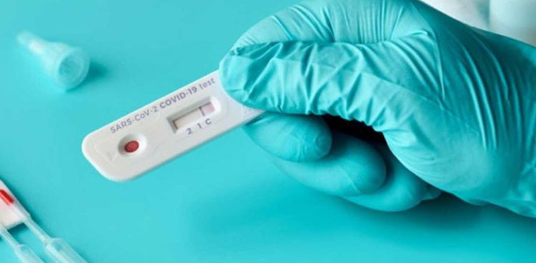 Peshawar peshawar test positivity rate