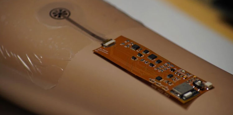 Singapore smart bandage