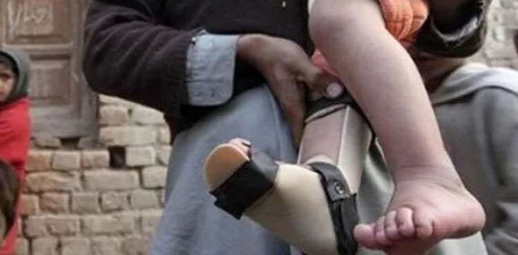 Polio-Pakistan, polio virus, polio in Pakistan, Pakistan , polio injection